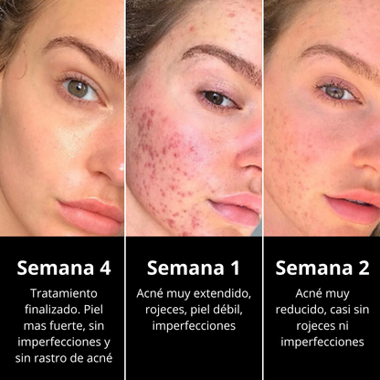 Crema de sebo de res